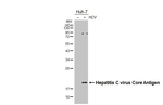 Hepatitis C Virus Core Antigen Recombinant Rabbit Monoclonal Antibody (HL4956)