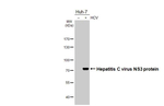 Hepatitis C Virus NS3 Antibody in Western Blot (WB)
