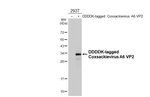 Coxsackievirus A6 VP2 Recombinant Rabbit Monoclonal Antibody (HL4965)