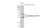 Coxsackievirus A6 VP2 Antibody in Western Blot (WB)