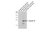 Claudin 18 Recombinant Rabbit Monoclonal Antibody (HL5023)