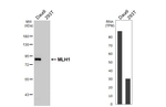 MLH1 Recombinant Rabbit Monoclonal Antibody (HL5028)