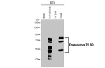 Enterovirus 71 3D Recombinant Rabbit Monoclonal Antibody (HL5128)