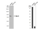 MLH1 Recombinant Rabbit Monoclonal Antibody (HL5175)