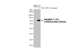 Hepatitis C Virus NS5a Recombinant Rabbit Monoclonal Antibody (HL5214)