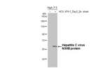 Hepatitis C Virus NS5b Recombinant Rabbit Monoclonal Antibody (HL5271)