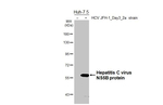 Hepatitis C Virus NS5b Recombinant Rabbit Monoclonal Antibody (HL5277)