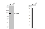 CD30 Recombinant Rabbit Monoclonal Antibody (HL5323)