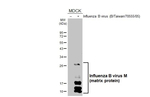 Influenza B M Recombinant Rabbit Monoclonal Antibody (HL5332)