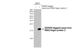 Lassa virus RING finger protein Z Antibody in Western Blot (WB)