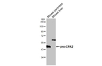 Carboxypeptidase A2 Recombinant Rabbit Monoclonal Antibody (HL5199)