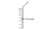 HTR4 Antibody in Western Blot (WB)