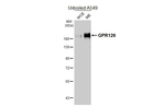 GPR126 Antibody in Western Blot (WB)