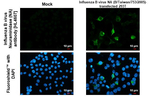 Influenza B NA Recombinant Rabbit Monoclonal Antibody (HL4607)