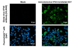Ebola Virus VP40 Recombinant Rabbit Monoclonal Antibody (HL4649)