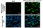 MERS Coronavirus Spike Protein S1 Recombinant Rabbit Monoclonal Antibody (HL4654)