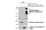 MERS Coronavirus Spike Protein S1 Antibody in Western Blot (WB)
