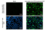 Ebola Virus VP35 Recombinant Rabbit Monoclonal Antibody (HL4726)