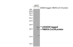 MERS Coronavirus M Antibody in Western Blot (WB)
