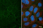 Desmocollin 2 Recombinant Rabbit Monoclonal Antibody (HL4655)