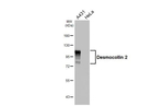 Desmocollin 2 Antibody in Western Blot (WB)