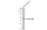 Factor XIII A Recombinant Rabbit Monoclonal Antibody (HL5069)