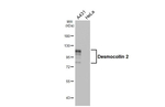Desmocollin 2 Recombinant Rabbit Monoclonal Antibody (HL4634)