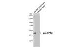 Carboxypeptidase A2 Antibody in Western Blot (WB)