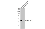 Carboxypeptidase A2 Antibody in Western Blot (WB)