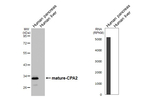 Carboxypeptidase A2 Recombinant Rabbit Monoclonal Antibody (HL5200)