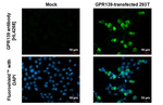 GPR139 Recombinant Rabbit Monoclonal Antibody (HL4268)
