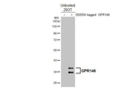 GPR146 Recombinant Rabbit Monoclonal Antibody (HL4489)
