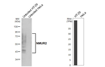 NMUR2 Recombinant Rabbit Monoclonal Antibody (HL4522)