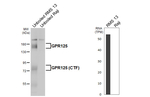 GPR125 Antibody in Western Blot (WB)