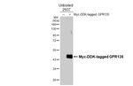 GPR135 Recombinant Rabbit Monoclonal Antibody (HL4668)