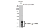 GPR31 Recombinant Rabbit Monoclonal Antibody (HL4702)