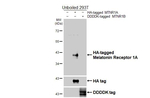 MTNR1A Antibody in Western Blot (WB)