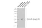 MTNR1A Antibody in Western Blot (WB)