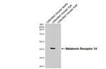 MTNR1A Recombinant Rabbit Monoclonal Antibody (HL4732)