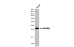 RAB9B Antibody in Western Blot (WB)