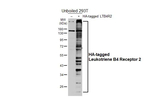 LTB4R2 Recombinant Rabbit Monoclonal Antibody (HL4803)