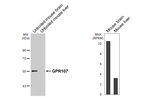 GPR107 Recombinant Rabbit Monoclonal Antibody (HL4815)
