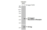 TACR2 Recombinant Rabbit Monoclonal Antibody (HL4859)