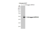 GPR151 Recombinant Rabbit Monoclonal Antibody (HL4860)