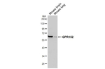 GPR152 Recombinant Rabbit Monoclonal Antibody (HL4936)