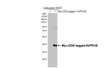 AVPR1B Recombinant Rabbit Monoclonal Antibody (HL4945)