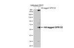 GPR132 Recombinant Rabbit Monoclonal Antibody (HL4946)