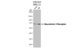 TACR3 Antibody in Western Blot (WB)