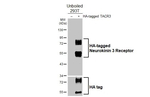 TACR3 Recombinant Rabbit Monoclonal Antibody (HL4983)