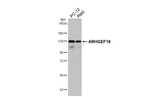ARHGEF18 Antibody in Western Blot (WB)